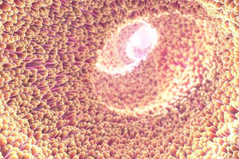 Colon irritable; Un diagnóstico impreciso que en muchos casos oculta trastornos reversibles y tratables